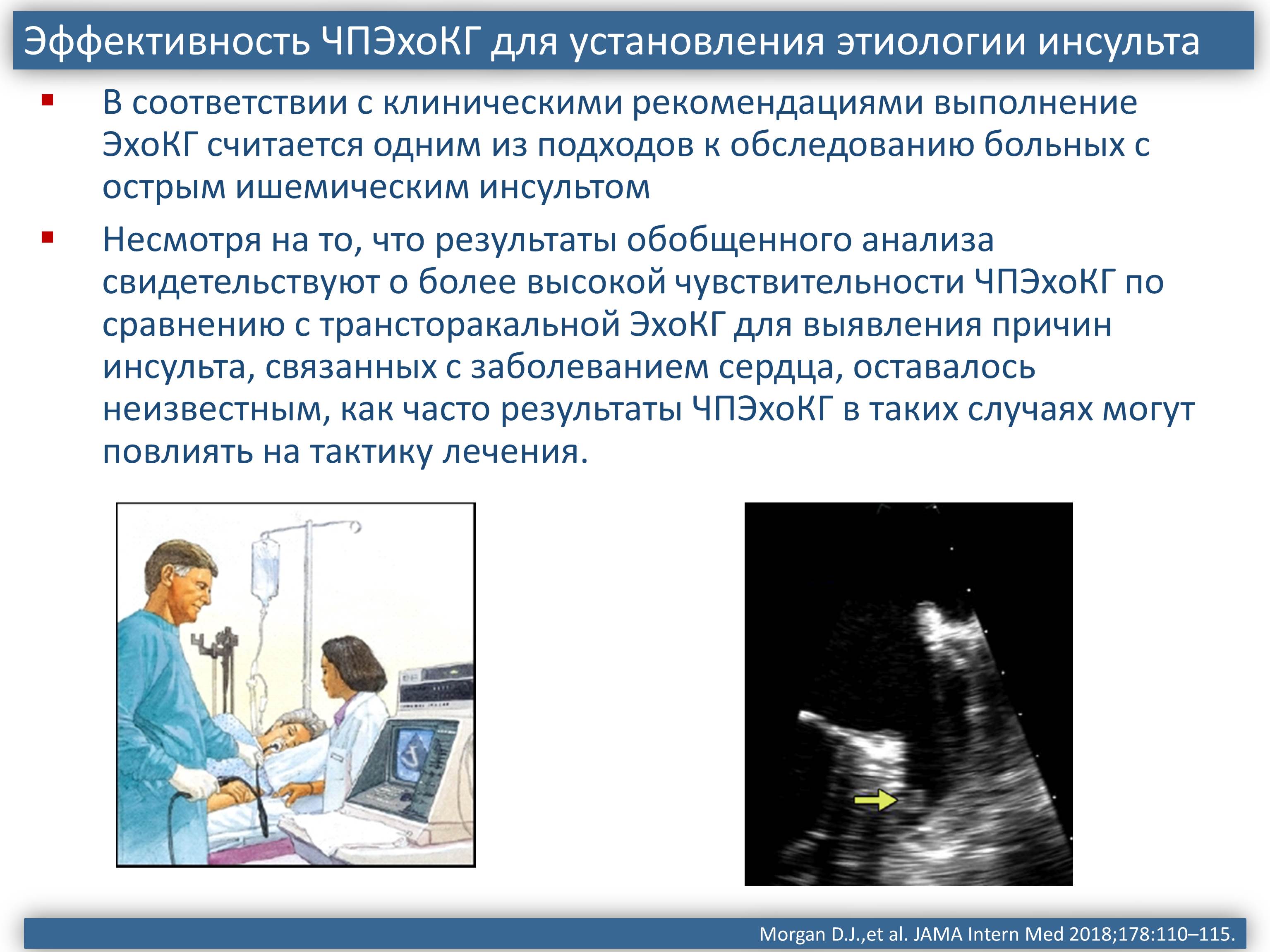 Эхокардиография что это за обследование. ЧП-Эхо-кг исследование что это. Методика проведения ЧПЭХОКГ. Чреспищеводная эхокардиография Интраоперационная. Чреспищеводная эхокардиография показания.